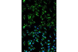 Immunofluorescence analysis of HeLa cell using TPM3 antibody. (TPM3 Antikörper  (AA 1-284))
