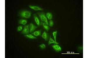 Immunofluorescence of monoclonal antibody to GMFB on HeLa cell. (GMFB Antikörper  (AA 1-154))