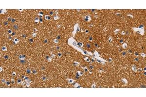 Immunohistochemistry of paraffin-embedded Human brain using GPM6A Polyclonal Antibody at dilution of 1:40 (GPM6A Antikörper)