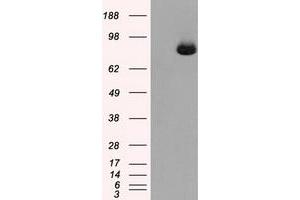 Image no. 6 for anti-Aconitase 2, Mitochondrial (ACO2) antibody (ABIN1496412) (ACO2 Antikörper)