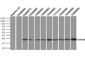 Image no. 4 for anti-Crystallin, alpha B (CRYAB) antibody (ABIN1497648) (CRYAB Antikörper)