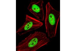 Fluorescent image of HeLa cells stained with Phospho-CDC25A Antibody A. (CDC25A Antikörper  (pThr507))