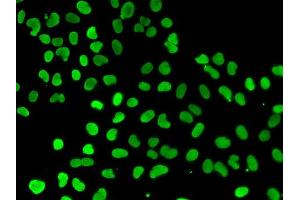 Immunofluorescence analysis of A549 cell using DNMT3L antibody. (DNMT3L Antikörper)