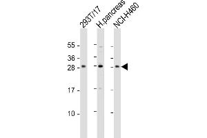 COMTD1 Antikörper  (C-Term)