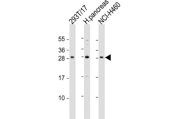 COMTD1 Antikörper  (C-Term)