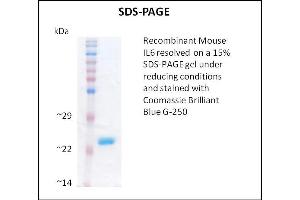 SDS-PAGE (SDS) image for Interleukin 6 (IL6) (Active) protein (ABIN5509357) (IL-6 Protein)