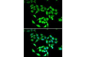 Immunofluorescence analysis of U2OS cells using CCT3 antibody. (CCT3 Antikörper  (AA 1-300))