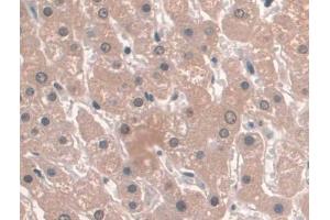 Detection of APOA1 in Human Liver Tissue using Recombinant Antibody to Apolipoprotein A1 (APOA1)