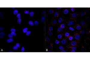 Immunocytochemistry/Immunofluorescence analysis using Mouse Anti-VPS35 Monoclonal Antibody, Clone 8A3 (ABIN6932966). (VPS35 Antikörper  (APC))