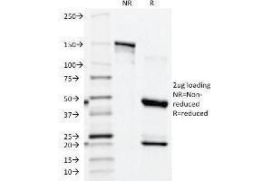 SDS-PAGE Analysis Purified PSAP Mouse Monoclonal Antibody (ACPP/1339). (ACPP Antikörper)