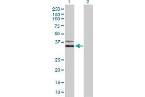 Western Blot analysis of PCGF6 expression in transfected 293T cell line by PCGF6 MaxPab polyclonal antibody. (PCGF6 Antikörper  (AA 1-277))