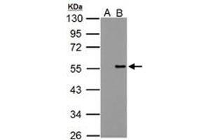 Image no. 1 for anti-Protein Phosphatase 4, Regulatory Subunit 2 (PPP4R2) (AA 1-360) antibody (ABIN1500387) (PPP4R2 Antikörper  (AA 1-360))