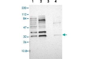 Western blot analysis of Lane 1: RT-4, Lane 2: U-251 MG, Lane 3: Liver, Lane 4: Tonsil with ZNF146 polyclonal antibody  at 1:250-1:500 dilution. (ZNF146 Antikörper)
