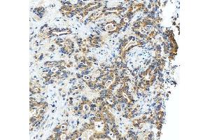 IHC analysis of RASAL1 using anti-RASAL1 antibody (ABIN6719367). (RASAL1 Antikörper  (AA 721-798))
