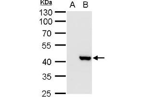 WB Image XRCC3 antibody detects XRCC3 protein by western blot analysis. (XRCC3 Antikörper)