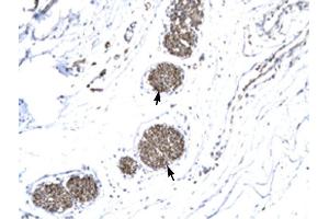 MMP19 antibody was used for immunohistochemistry at a concentration of 4-8 ug/ml to stain Ganglionic cells (arrows) in Human urinary bladder. (MMP19 Antikörper  (N-Term))