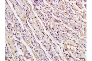 Formalin-fixed and paraffin embedded human endometrial tissue labeled with Anti XRCC4 Polyclonal Antibody, Unconjugated (ABIN1386856) at 1:200 followed by conjugation to the secondary antibody and DAB staining (XRCC4 Antikörper  (AA 151-260))
