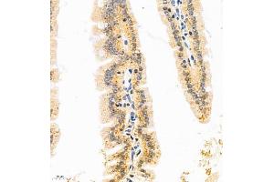 Immunohistochemistry of paraffin embedded mouse duodenum using GDPD2 (ABIN7074098) at dilution of 1:650 (400x lens) (GDPD2 Antikörper)