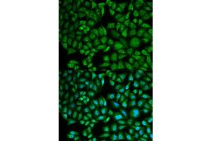 Immunofluorescence analysis of MCF-7 cells using CTSA antibody (ABIN5973211).