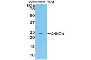 Western Blotting (WB) image for anti-Leukocyte Immunoglobulin-Like Receptor, Subfamily B (With TM and ITIM Domains), Member 4 (LILRB4) (AA 24-206) antibody (ABIN1859666) (LILRB4 Antikörper  (AA 24-206))