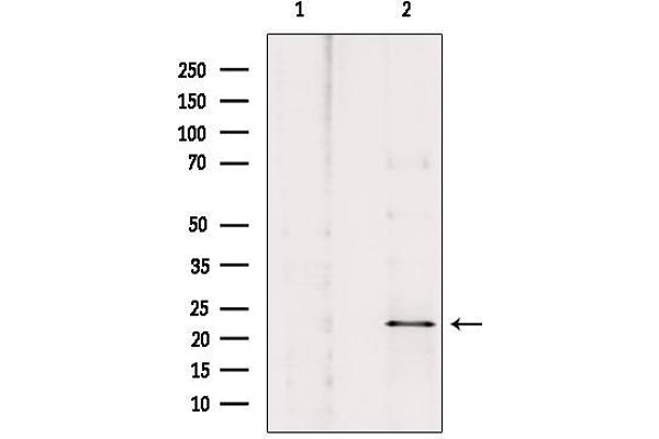 NOL3 Antikörper  (C-Term)