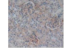 Detection of CFH in Rat Kidney Tissue using Polyclonal Antibody to Complement Factor H (CFH) (Complement Factor H Antikörper  (AA 975-1217))