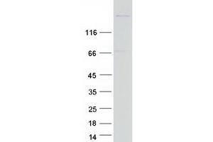 Western Blotting (WB) image for Myosin Heavy Chain 4, Skeletal Muscle (MYH4) protein (Myc-DYKDDDDK Tag) (ABIN2726658)