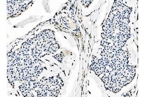 IHC analysis of splicing factor 1 using anti-splicing factor 1 antibody (ABIN7600193).