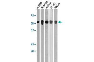 The CHEK1 (phospho S280) polyclonal antibody  is used in Western blot to detect Phospho-CHK1-S280 in, from left to right, A2058, Ramos, Jurkat, HL-60, and Hela cell lysates.