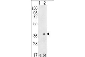 Western blot analysis of HLA-DQA1 (arrow) using rabbit polyclonal HLA-DQA1 Antibody (N-term) (ABIN656108 and ABIN2837859). (HLA-DQA1 Antikörper  (N-Term))