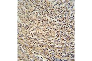 Immunohistochemistry (Paraffin-embedded Sections) (IHC (p)) image for anti-Melanomaderived Leucine Zipper Extra-Nuclear Factor (MLZE) (AA 221-250), (Middle Region) antibody (ABIN952464)