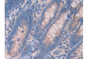 Immunohistochemistry (IHC) image for anti-Ubiquitin D (UBD) (AA 1-155) antibody (ABIN7442102)