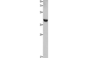 Western Blotting (WB) image for anti-Matrix Metallopeptidase 28 (MMP28) antibody (ABIN2421863) (MMP28 Antikörper)
