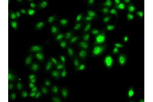 Immunofluorescence analysis of U20S cell using CBFA2T2 antibody.