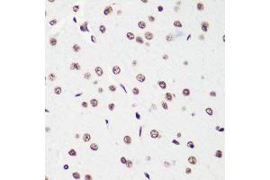 Immunohistochemistry (Paraffin-embedded Sections) (IHC (p)) image for anti-Histone H4 (2meLys20) antibody (ABIN3016048)