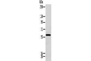 Western blot analysis of Human kidney tissue using ZNF248 Polyclonal Antibody at dilution of 1:200 (ZNF248 Antikörper)