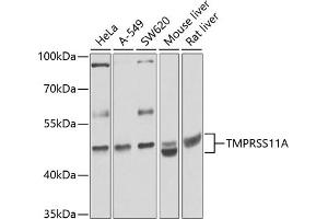 Western blot analysis of extracts of various cell lines, using TMPRSS11A antibody (ABIN6133161, ABIN6149279, ABIN6149281 and ABIN6224715) at 1:1000 dilution. (TMPRSS11A Antikörper  (AA 300-421))