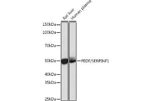 Western blot analysis of extracts of various cell lines, using PEDF/SERPINF1 Rabbit mAb (ABIN7270247) at 1:1000 dilution. (PEDF Antikörper)