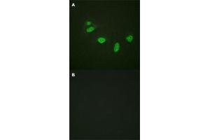 Immunofluorescence staining of methanol-fixed HeLa cells with ETS1 (phospho T38) polyclonal antibody  without blocking peptide (A) or preincubated with blocking peptide (B) at 1:100-1:200 dilution.