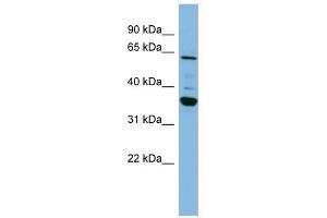 CYP3A7 antibody used at 1 ug/ml to detect target protein. (CYP3A7 Antikörper  (Middle Region))