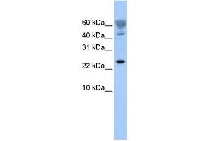 FUNDC1 antibody used at 1 ug/ml to detect target protein. (FUNDC1 Antikörper  (Middle Region))