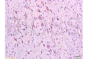 Formalin-fixed and paraffin embedded rat brain tissue labeled with Anti-DRD1 Polyclonal Antibody, Unconjugated (ABIN730843) at 1:300, followed by conjugation to the secondary antibody and DAB staining (Dopamine Receptor d1 Antikörper  (AA 101-200))