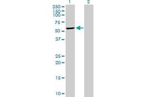 Western Blot analysis of MLKL expression in transfected 293T cell line by MLKL MaxPab polyclonal antibody. (MLKL Antikörper  (AA 1-471))