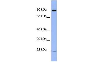 Host:  Rabbit  Target Name:  ZNF780B  Sample Type:  ACHN Whole cell lysates  Antibody Dilution:  1. (ZNF780B Antikörper  (N-Term))