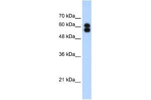 WB Suggested Anti-ALPP Antibody Titration:  1. (PLAP Antikörper  (C-Term))