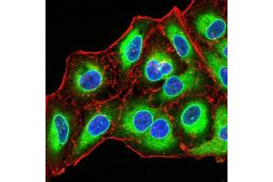 Immunocytochemistry (ICC) image for anti-Emerin (EMD) (AA 1-222) antibody (ABIN5864847) (Emerin Antikörper  (AA 1-222))