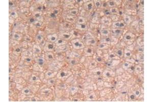 IHC-P analysis of Human Liver Tissue, with DAB staining. (IL-4 Antikörper)
