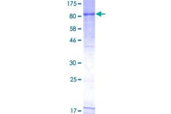 RIOK3 Protein (AA 1-516) (GST tag)