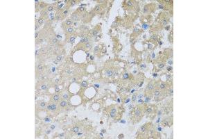 Immunohistochemistry of paraffin-embedded human liver injury using CHMP1B antibody at dilution of 1:100 (x40 lens). (CHMP1B Antikörper)