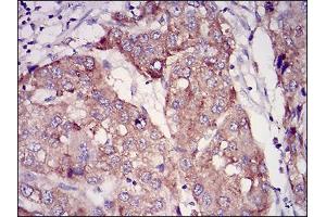 Immunohistochemistry (IHC) image for anti-RAB27A, Member RAS Oncogene Family (RAB27A) (AA 1-221) antibody (ABIN2683011)